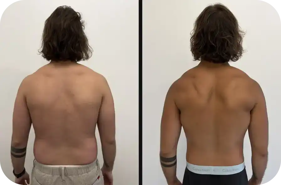 Transformation gallery 6